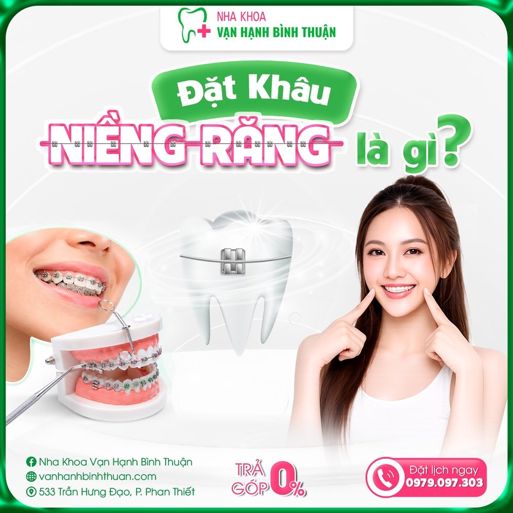 Đặt Khâu Niềng Răng Là Gì? Công Dụng, Các Loại Band Và Quy Trình Thực Hiện